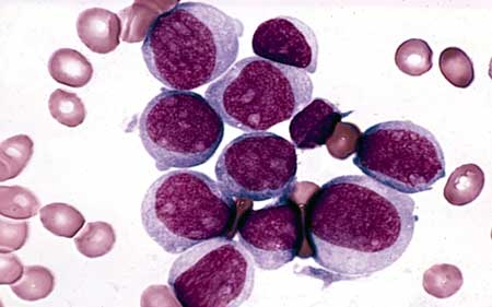 خون شناسی Hematology