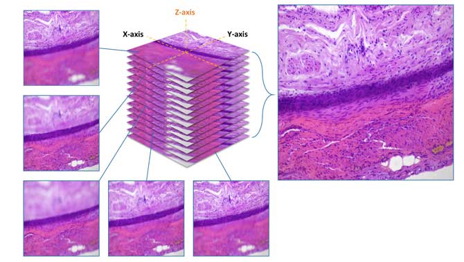 Normal Focus scan