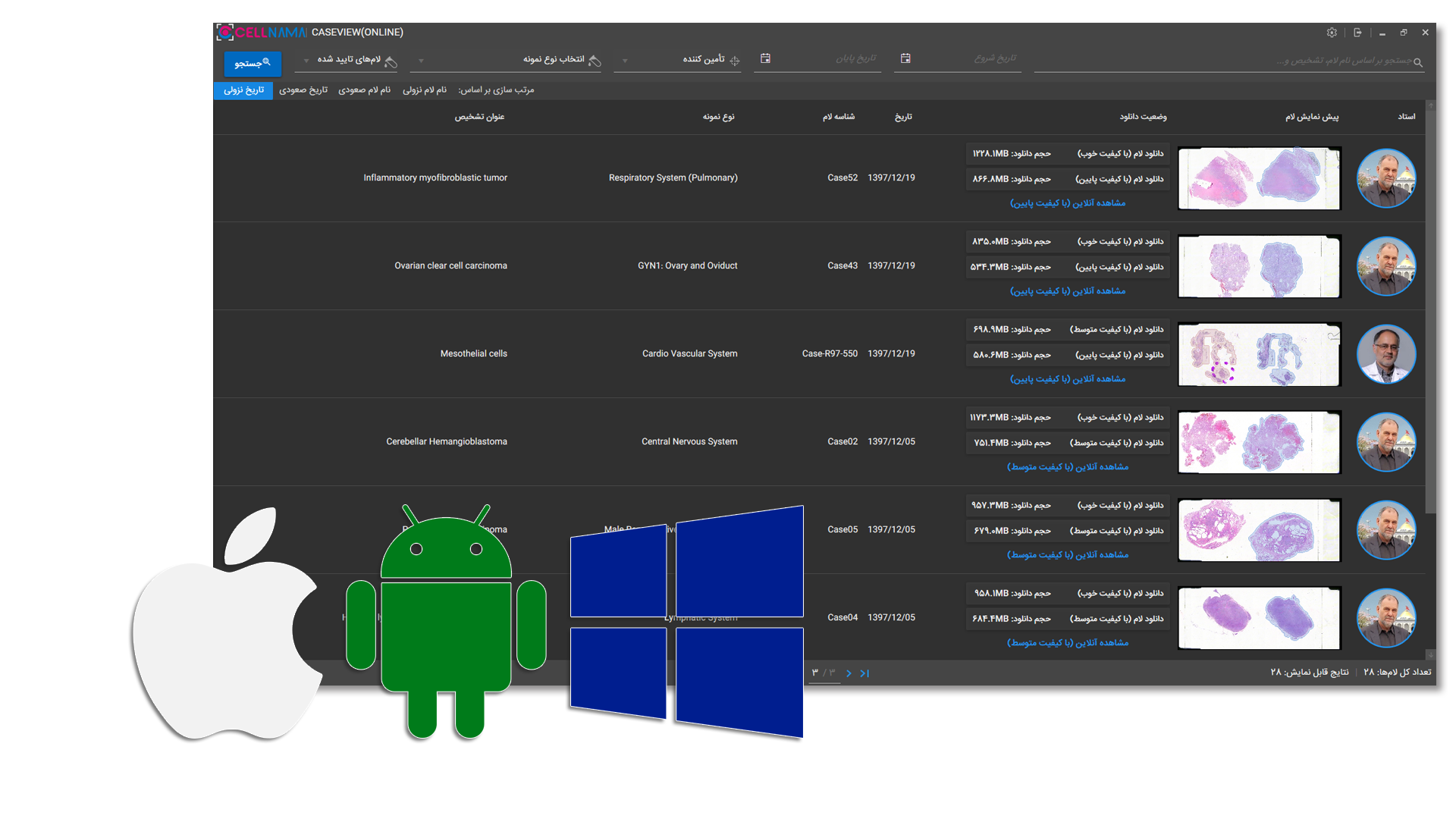 caseviewer