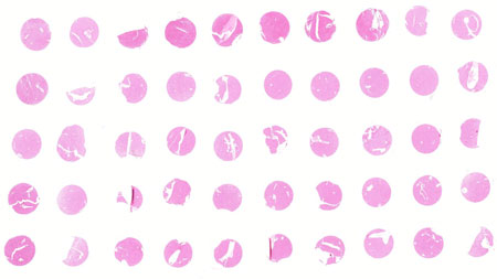 میکرو آرایه های بافت