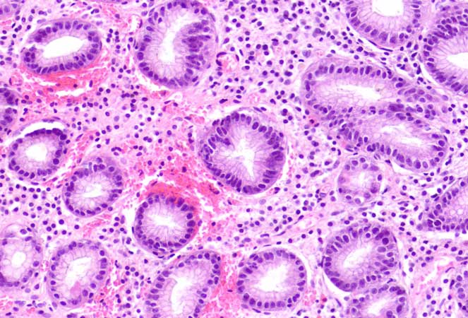 پاتولوژی عمومی